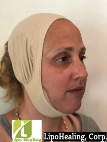 https://facialstrap.com/collections/face-accessories/products/chin-support-strap-one-size-with-lipo-foam-strips-by-lipohealing-llc